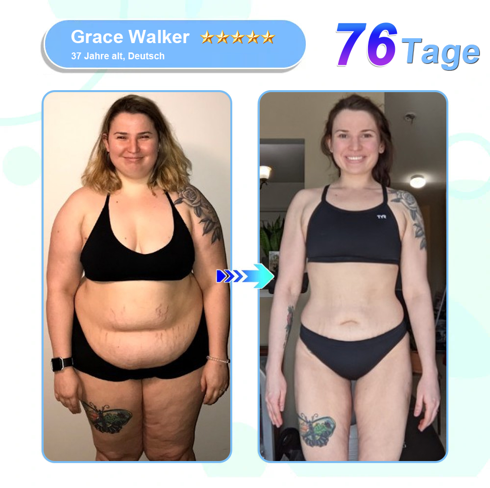 DE Offizieller Laden: Lmipki® 𝐍𝐈𝐃𝐃𝐊-𝐓𝐢𝐫𝐳𝐞𝐩𝐚𝐭𝐢𝐝𝐞 𝐍𝐚𝐧𝐨 Mikronadeln Pflaster⚡（（Balancieren den Blutzucker, schmerzfrei, ohne Nebenwirkungen. Geeignet für Adipositas und Diabetes.）🤩