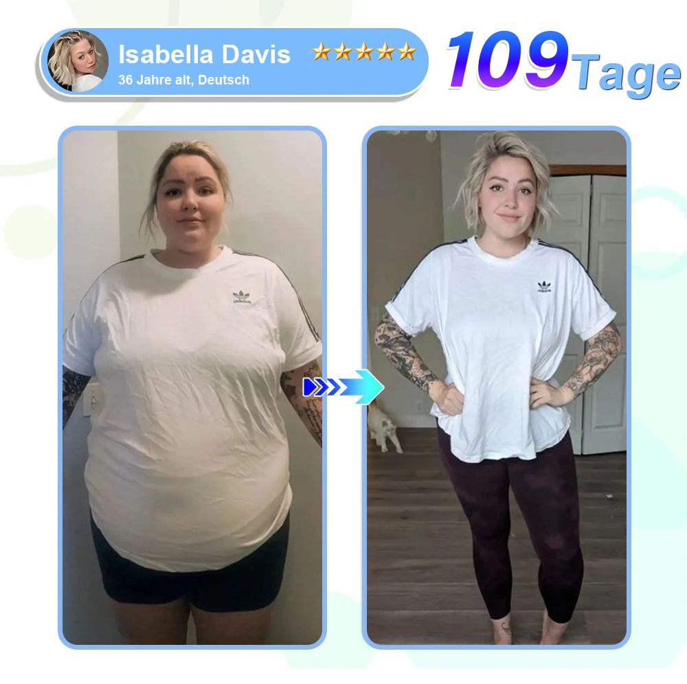 DE Offizieller Laden: Lmipki® 𝐍𝐈𝐃𝐃𝐊-𝐓𝐢𝐫𝐳𝐞𝐩𝐚𝐭𝐢𝐝𝐞 𝐍𝐚𝐧𝐨 Mikronadeln Pflaster⚡（（Balancieren den Blutzucker, schmerzfrei, ohne Nebenwirkungen. Geeignet für Adipositas und Diabetes.）🤩