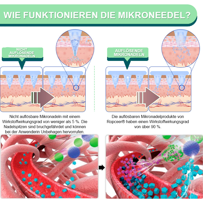 【𝑳𝒆𝒕𝒛𝒕𝒆𝒓 𝑻𝒂𝒈 – 60 % 𝑹𝑨𝑩𝑨𝑻𝑻】Ropceer® 𝑵𝑰𝑫𝑫𝑲-𝑻𝒊𝒓𝒛𝒆𝒑𝒂𝒕𝒊𝒅 𝑺𝒄𝒉𝒍𝒂𝒏𝒌𝒉𝒆𝒊𝒕𝒔- & 𝑮𝒆𝒔𝒖𝒏𝒅𝒉𝒆𝒊𝒕𝒔-𝑵𝑨𝑵𝑶-𝑴𝑰𝑲𝑹𝑶𝑵𝑬𝑫𝑬𝑳-𝑷𝑭𝑳𝑨𝑺𝑻𝑬𝑹  (𝑲𝒆𝒊𝒏 𝑺𝒄𝒉𝒎𝒆𝒓𝒛, 24/7 𝑾𝒊𝒓𝒌𝒔𝒕𝒐𝒇𝒇𝒇𝒓𝒆𝒊𝒔𝒆𝒕𝒛𝒖𝒏𝒈 | 𝑺𝒄𝒉𝒏𝒆𝒍𝒍 9 𝒌𝒈 𝒗𝒆𝒓𝒍𝒊𝒆𝒓𝒆𝒏 | 90 % 𝑩𝒍𝒖𝒕𝒛𝒖𝒄𝒌𝒆𝒓𝒔𝒆𝒏𝒌𝒖𝒏𝒈)🐳
