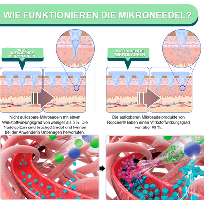 【𝑳𝒆𝒕𝒛𝒕𝒆𝒓 𝑻𝒂𝒈 – 60 % 𝑹𝑨𝑩𝑨𝑻𝑻】Ropceer® 𝑵𝑰𝑫𝑫𝑲-𝑻𝒊𝒓𝒛𝒆𝒑𝒂𝒕𝒊𝒅 𝑺𝒄𝒉𝒍𝒂𝒏𝒌𝒉𝒆𝒊𝒕𝒔- & 𝑮𝒆𝒔𝒖𝒏𝒅𝒉𝒆𝒊𝒕𝒔-𝑵𝑨𝑵𝑶-𝑴𝑰𝑲𝑹𝑶𝑵𝑬𝑫𝑬𝑳-𝑷𝑭𝑳𝑨𝑺𝑻𝑬𝑹  (𝑲𝒆𝒊𝒏 𝑺𝒄𝒉𝒎𝒆𝒓𝒛, 24/7 𝑾𝒊𝒓𝒌𝒔𝒕𝒐𝒇𝒇𝒇𝒓𝒆𝒊𝒔𝒆𝒕𝒛𝒖𝒏𝒈 | 𝑺𝒄𝒉𝒏𝒆𝒍𝒍 9 𝒌𝒈 𝒗𝒆𝒓𝒍𝒊𝒆𝒓𝒆𝒏 | 90 % 𝑩𝒍𝒖𝒕𝒛𝒖𝒄𝒌𝒆𝒓𝒔𝒆𝒏𝒌𝒖𝒏𝒈)🐳